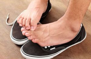 Athlete's Foot 1 Athletes Foot 2
