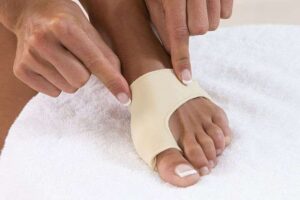 Bunions 4