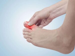 Ingrown Toe Nails 5