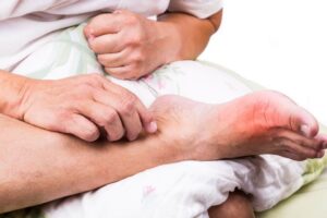 Elevated Foot 