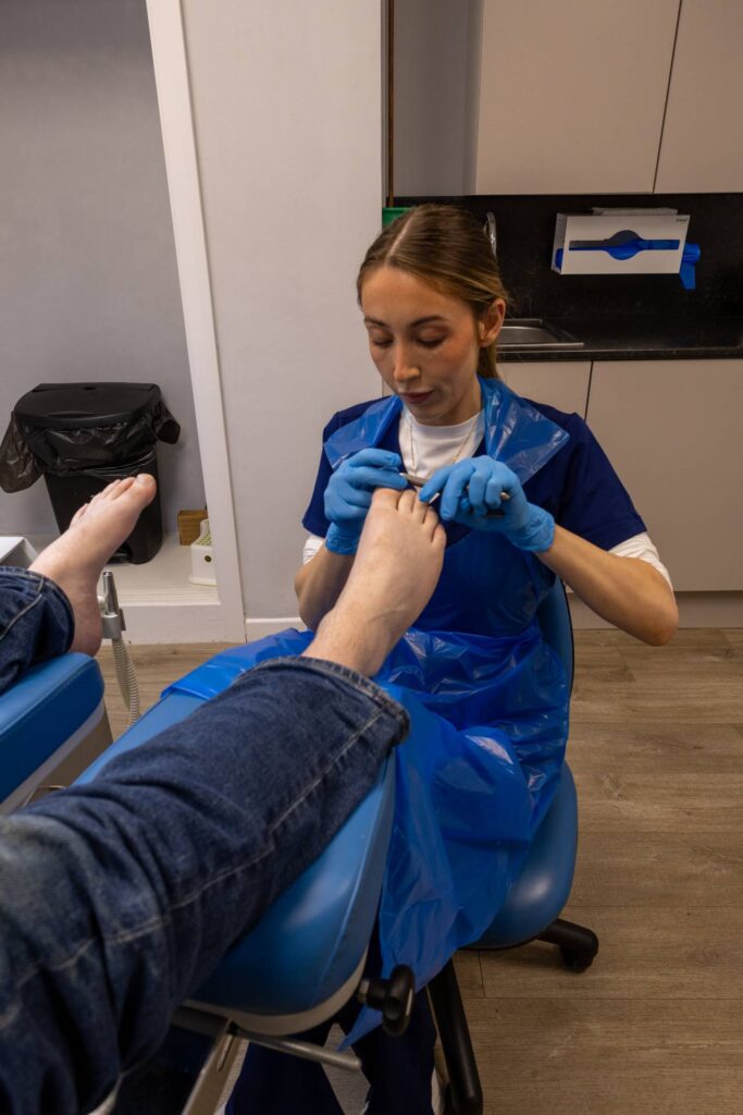 Nail Conditions